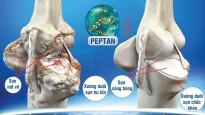 Peptan thiên nhiên giúp điều trị bệnh xương khớp vượt trội