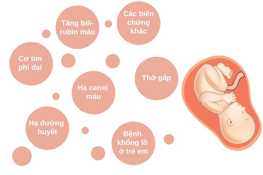 Tiểu đường thai kỳ gây nhiều biến chứng nguy hiểm cho thai nhi